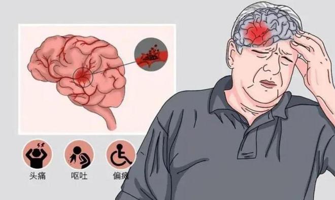女保洁干活突发脑梗称是因雇主冰箱太臭？要求雇爱体育平台主拿70%医药费(图4)
