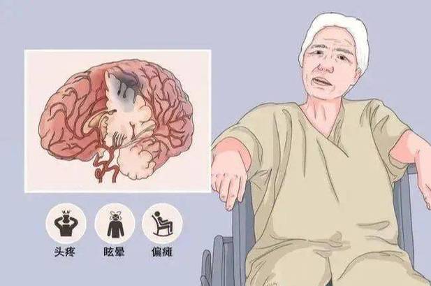 女保洁干活突发脑梗称是因雇主冰箱太臭？要求雇爱体育平台主拿70%医药费(图6)